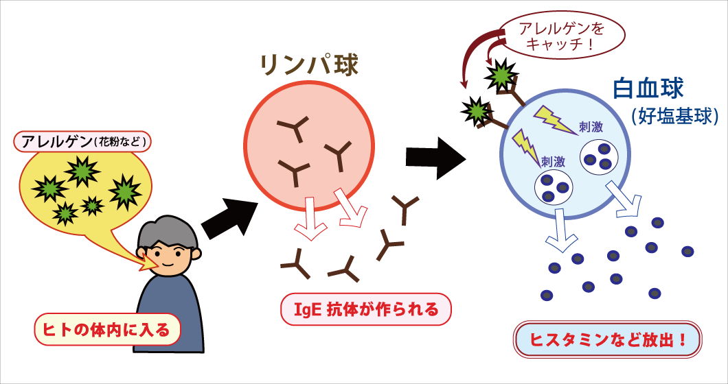 花粉症を引き起こすIgE抗体〜ヒスタミン放出の図解