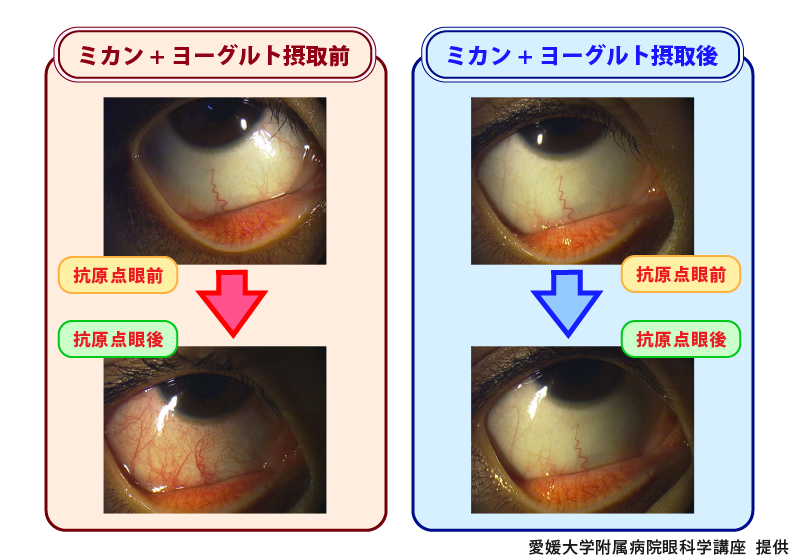 摂取前と摂取後で、抗原を人に点眼した時の反応を記録した資料。確かに効果がみてとれる